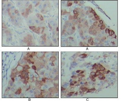 PEG10 Antibody in Immunohistochemistry (Paraffin) (IHC (P))