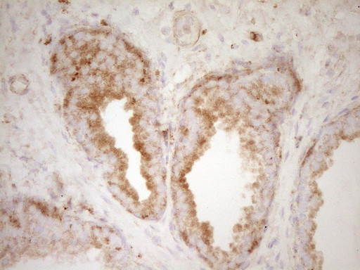 PELI1 Antibody in Immunohistochemistry (Paraffin) (IHC (P))