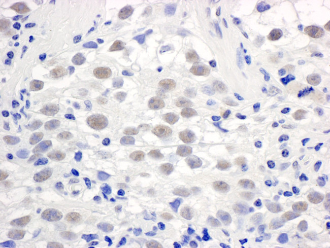 PELP1/MNAR Antibody in Immunohistochemistry (IHC)