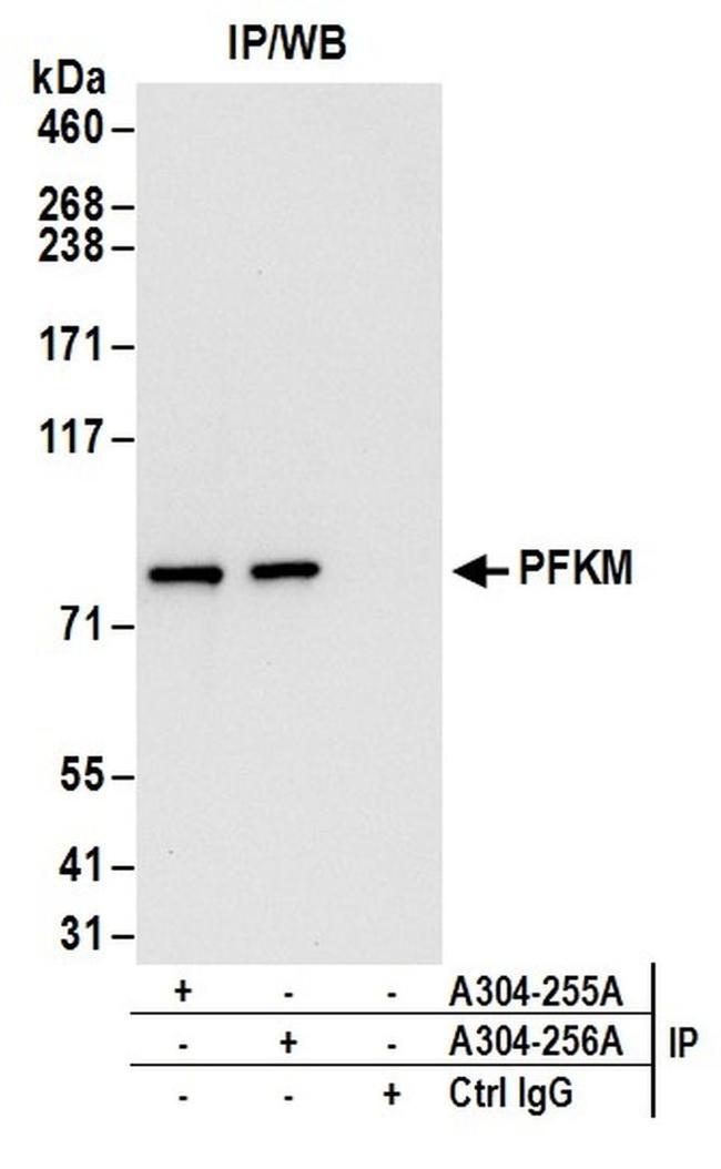 PFKM Antibody in Western Blot (WB)