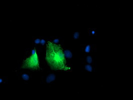 PFKP Antibody in Immunocytochemistry (ICC/IF)