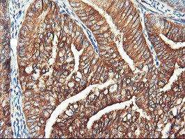 PFKP Antibody in Immunohistochemistry (Paraffin) (IHC (P))