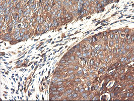 PFKP Antibody in Immunohistochemistry (Paraffin) (IHC (P))