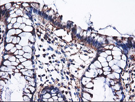 PFKP Antibody in Immunohistochemistry (Paraffin) (IHC (P))