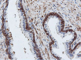 PFKP Antibody in Immunohistochemistry (Paraffin) (IHC (P))