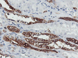 PFKP Antibody in Immunohistochemistry (Paraffin) (IHC (P))