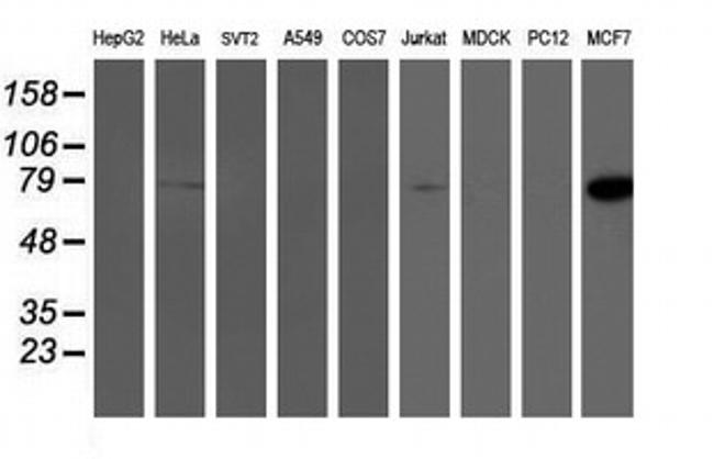 PFKP Antibody in Western Blot (WB)