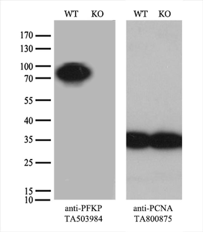 PFKP Antibody in Western Blot (WB)