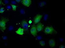 PFN1 Antibody in Immunocytochemistry (ICC/IF)