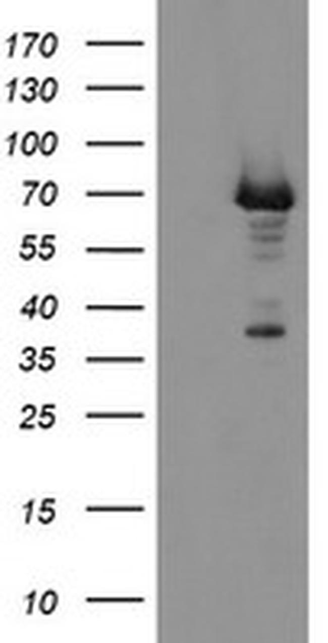 PGM3 Antibody in Western Blot (WB)