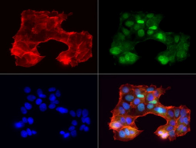 PGR Antibody in Immunocytochemistry (ICC/IF)