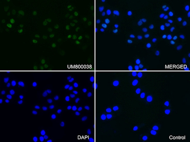 PGR Antibody in Immunocytochemistry (ICC/IF)