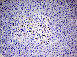 PGR Antibody in Immunohistochemistry (Paraffin) (IHC (P))