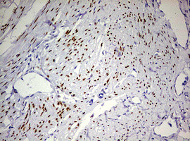 PGR Antibody in Immunohistochemistry (Paraffin) (IHC (P))