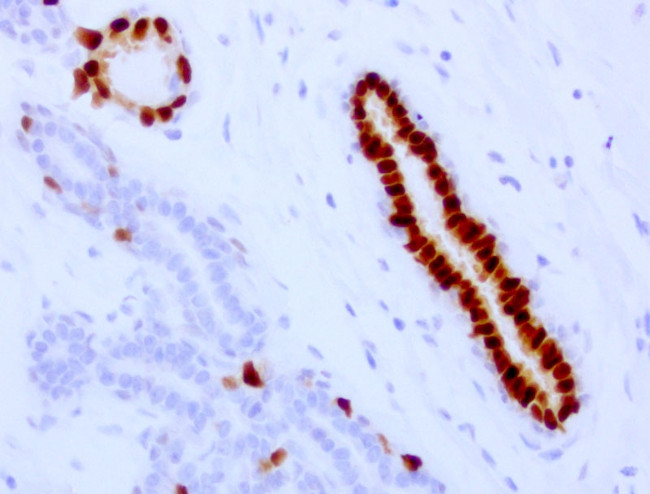 PGR Antibody in Immunohistochemistry (Paraffin) (IHC (P))