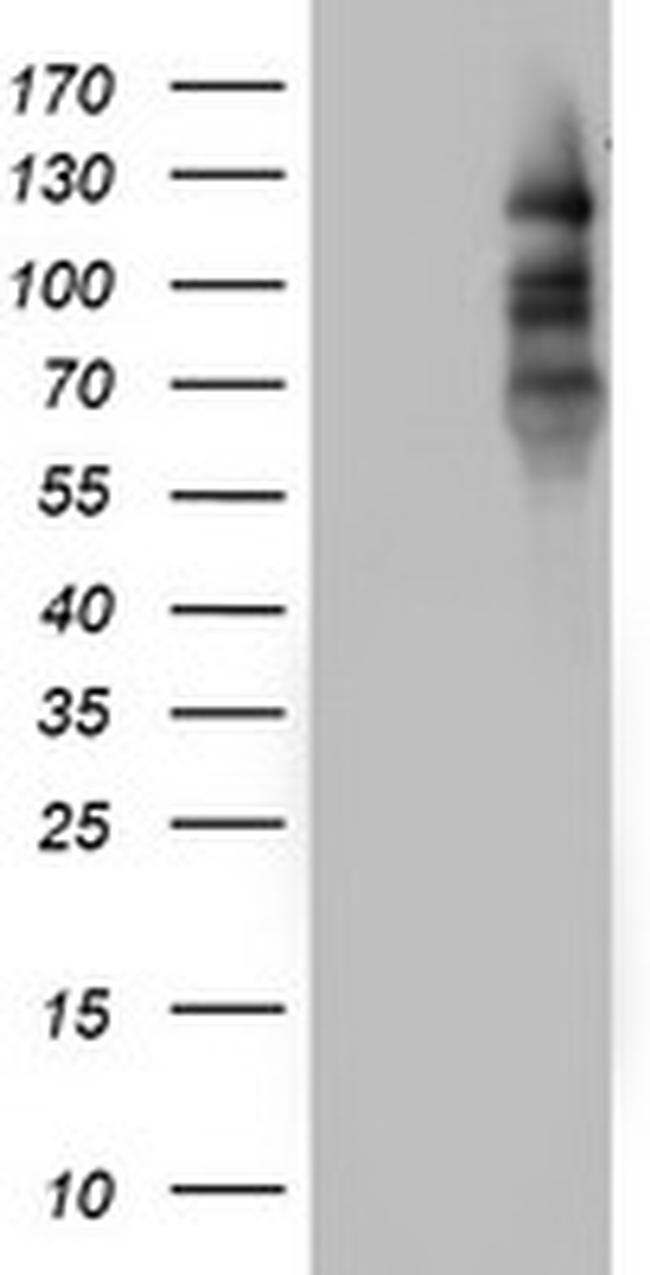 PGR Antibody in Western Blot (WB)