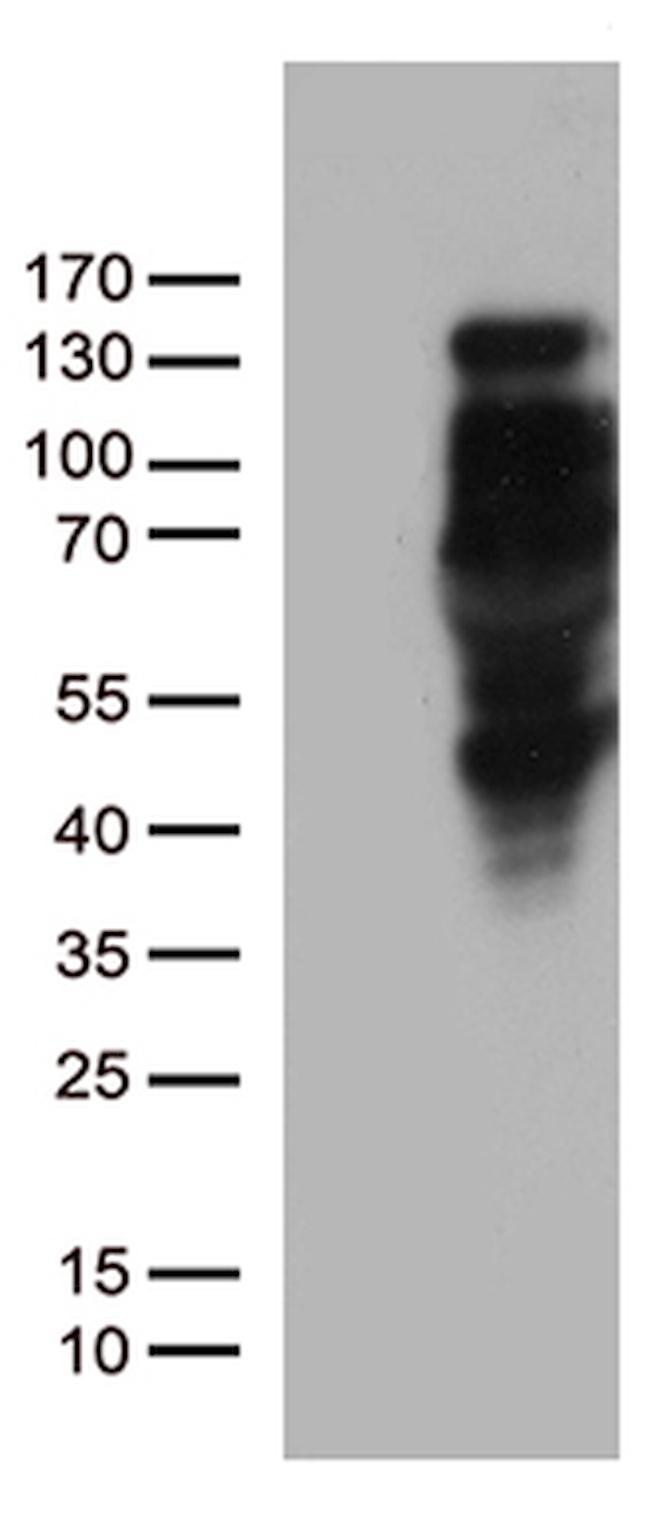 PGR Antibody in Western Blot (WB)