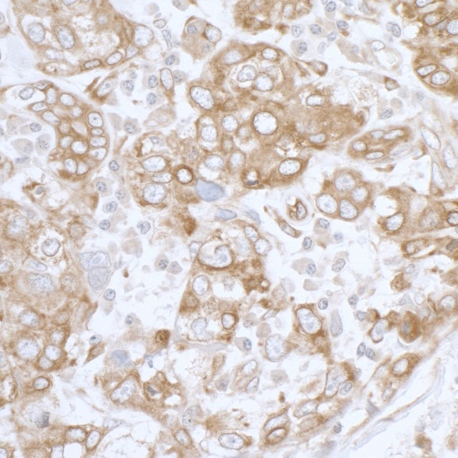 PGRMC1 Antibody in Immunohistochemistry (IHC)