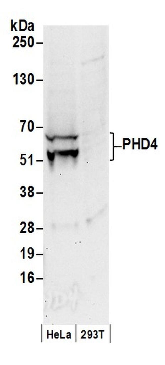 PHD4 Antibody in Western Blot (WB)