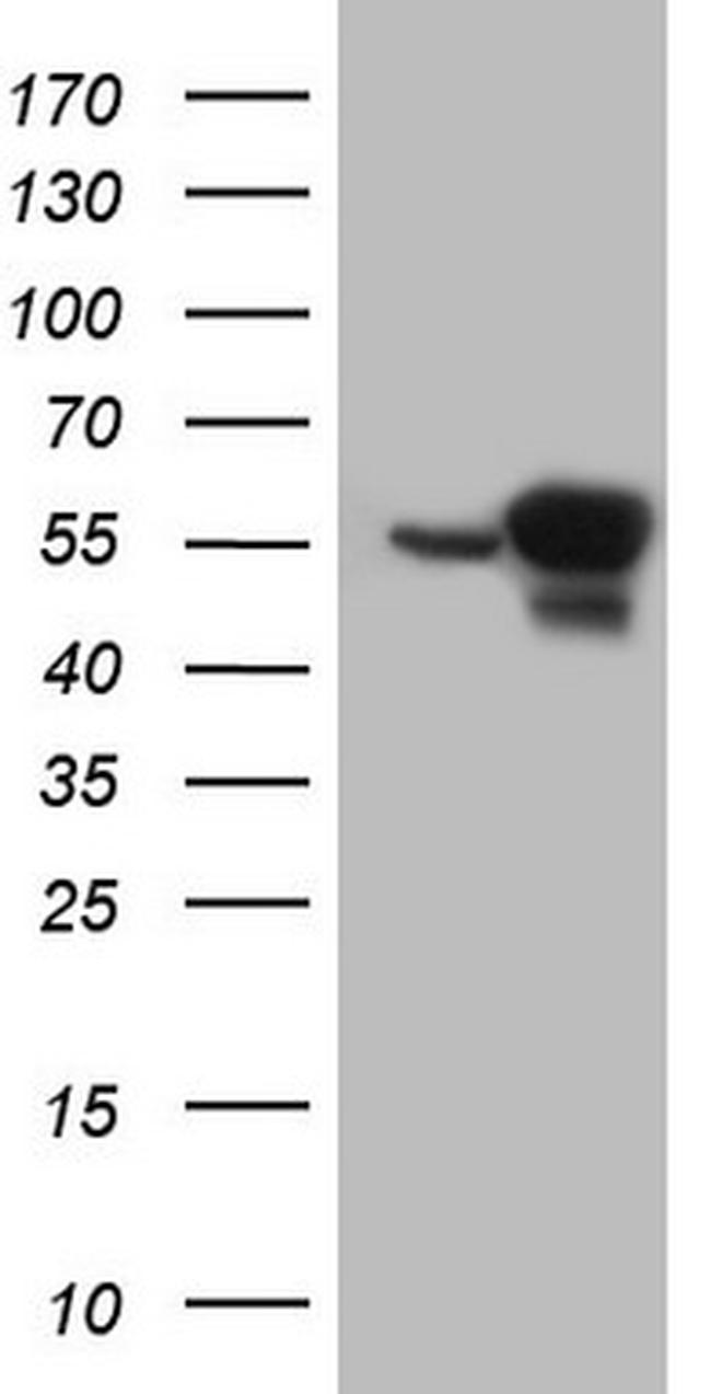 PHGDH Antibody in Western Blot (WB)