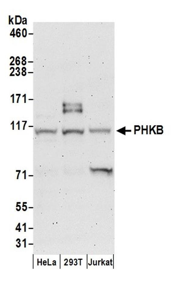 PHKB Antibody in Western Blot (WB)