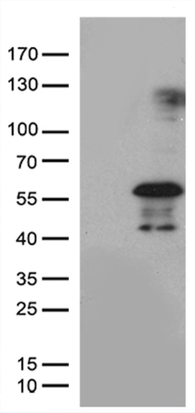 PHLDA1 Antibody in Western Blot (WB)