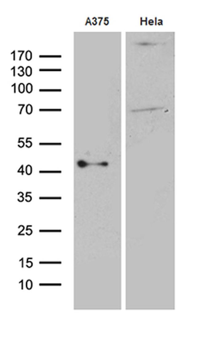 PHLDA1 Antibody in Western Blot (WB)