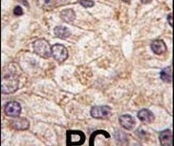 PI4K2B Antibody in Immunohistochemistry (IHC)