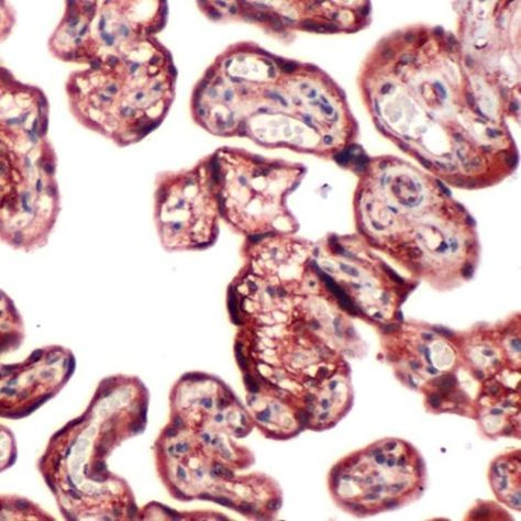 PI3K p85 alpha Antibody in Immunohistochemistry (Paraffin) (IHC (P))