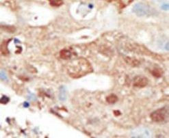 PIK3R2 Antibody in Immunohistochemistry (IHC)