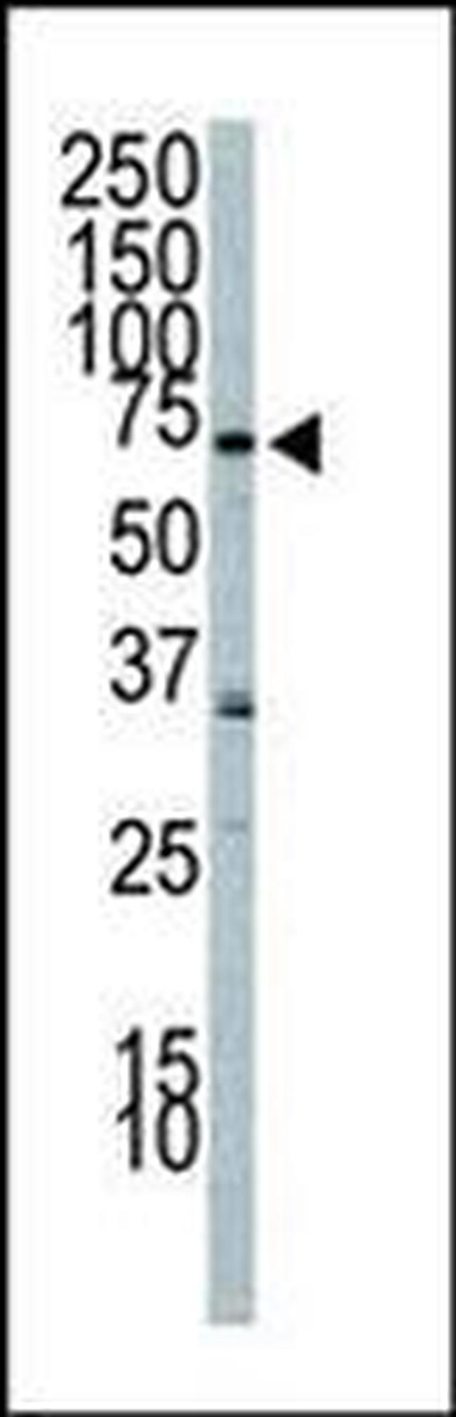 PIK3R2 Antibody in Western Blot (WB)