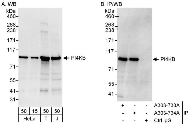 PI4KB Antibody in Western Blot (WB)