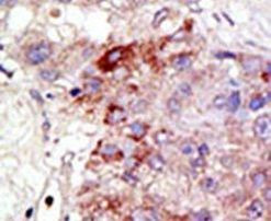 PIAS1 Antibody in Immunohistochemistry (IHC)