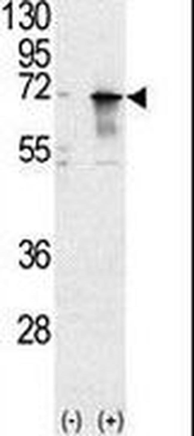 PIAS1 Antibody in Western Blot (WB)