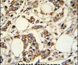 PIGM Antibody in Immunohistochemistry (IHC)