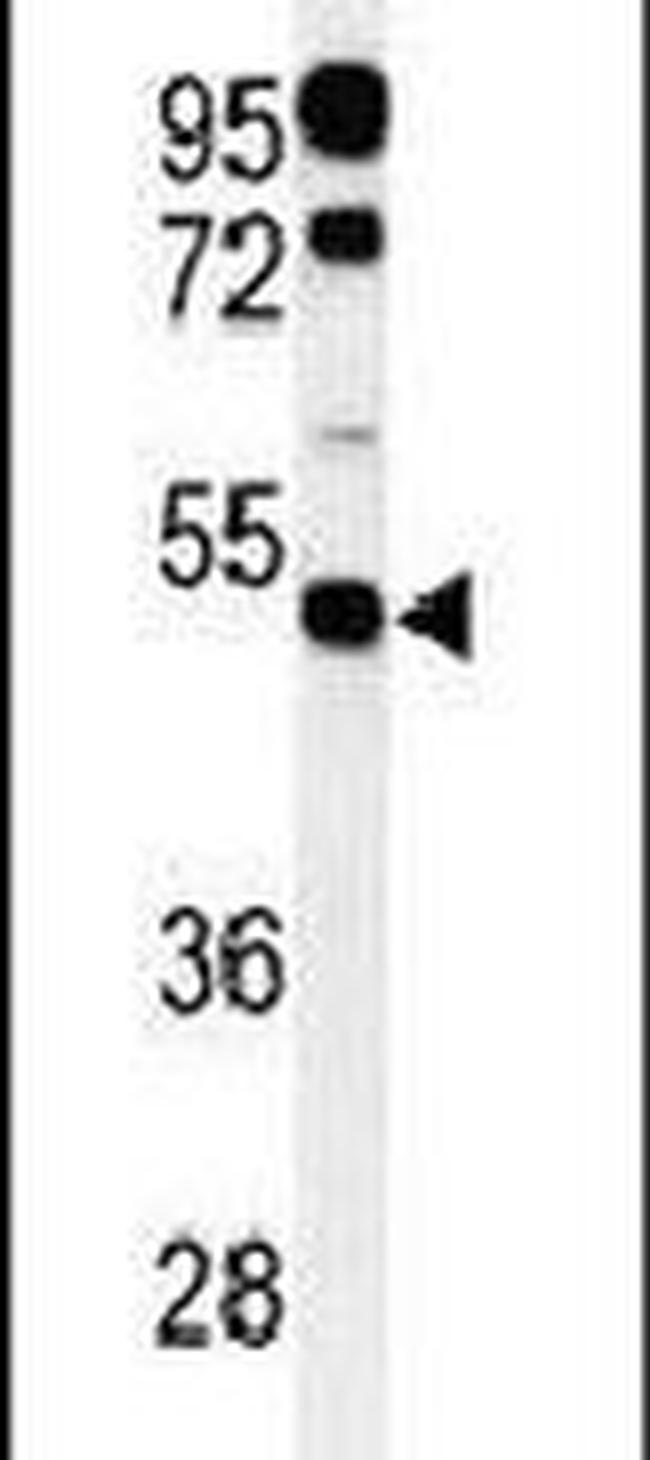 PIGM Antibody in Western Blot (WB)