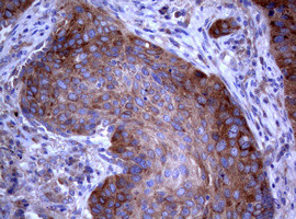 PIK3C2A Antibody in Immunohistochemistry (Paraffin) (IHC (P))