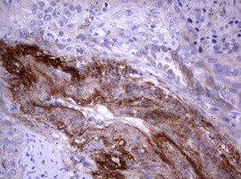 PIK3C2A Antibody in Immunohistochemistry (Paraffin) (IHC (P))