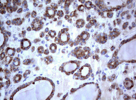 PIK3C2A Antibody in Immunohistochemistry (Paraffin) (IHC (P))