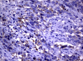 PIK3C2A Antibody in Immunohistochemistry (Paraffin) (IHC (P))