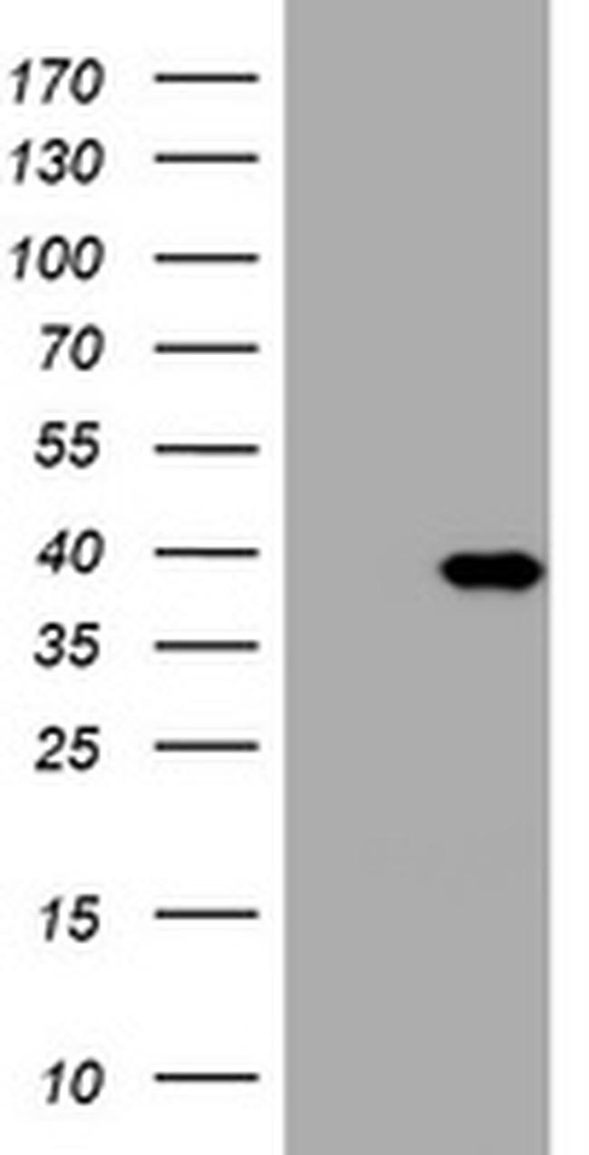 PIK3C2A Antibody in Western Blot (WB)