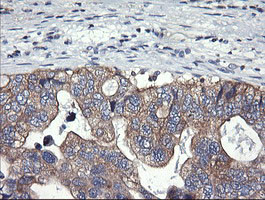 PIK3C2B Antibody in Immunohistochemistry (Paraffin) (IHC (P))