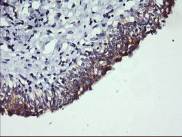 PIK3C2B Antibody in Immunohistochemistry (Paraffin) (IHC (P))