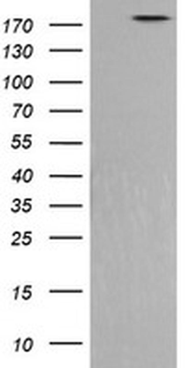 PIK3C2B Antibody in Western Blot (WB)