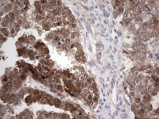 PIK3CA Antibody in Immunohistochemistry (Paraffin) (IHC (P))