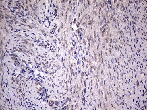 PIK3CA Antibody in Immunohistochemistry (Paraffin) (IHC (P))