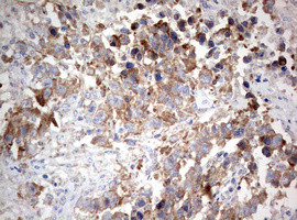 PIK3CA Antibody in Immunohistochemistry (Paraffin) (IHC (P))