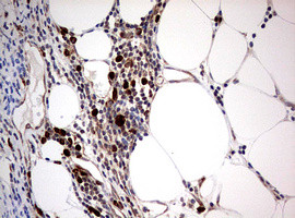 PIK3CA Antibody in Immunohistochemistry (Paraffin) (IHC (P))