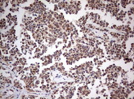 PIK3CA Antibody in Immunohistochemistry (Paraffin) (IHC (P))