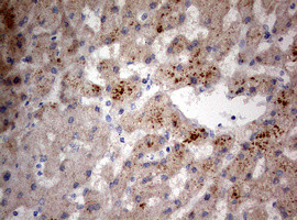 PIK3CA Antibody in Immunohistochemistry (Paraffin) (IHC (P))